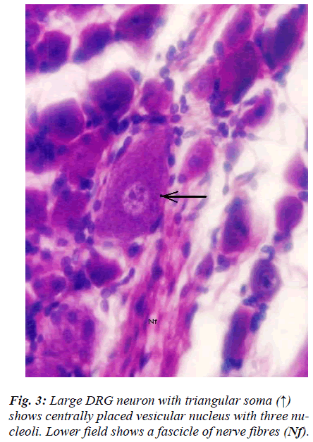 biomedres-Large-DRG-neuron