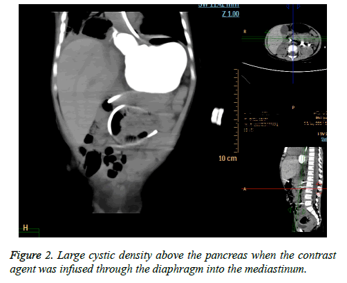 biomedres-Large-cystic