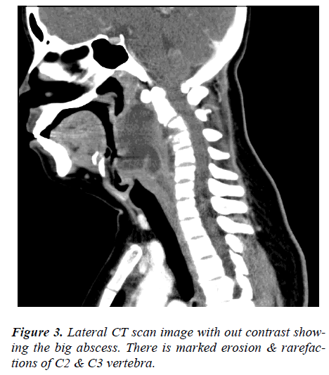 biomedres-Lateral-CT-scan-image