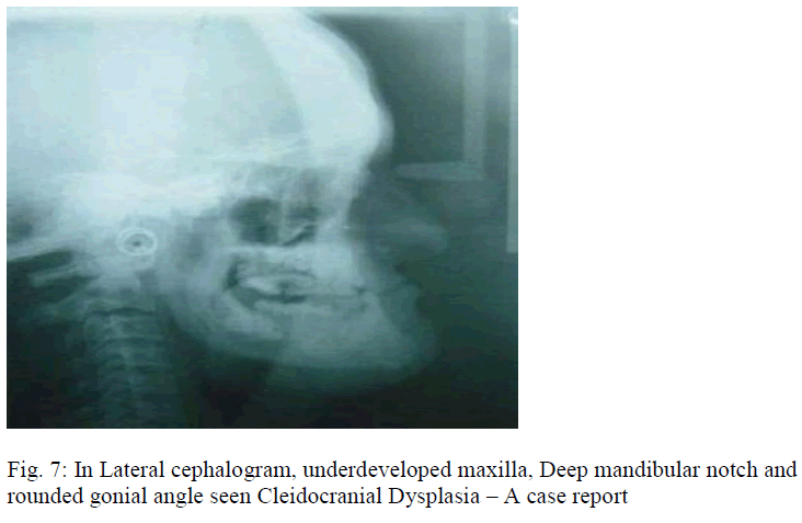 biomedres-Lateral-cephalogram