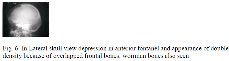 biomedres-Lateral-skull