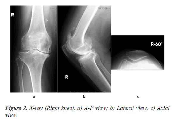 biomedres-Lateral-view