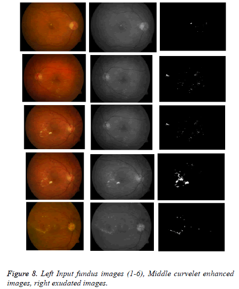 biomedres-Left-Input-fundus