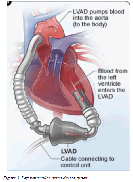 biomedres-Left-ventricular