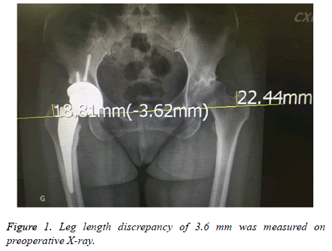 biomedres-Leg-length