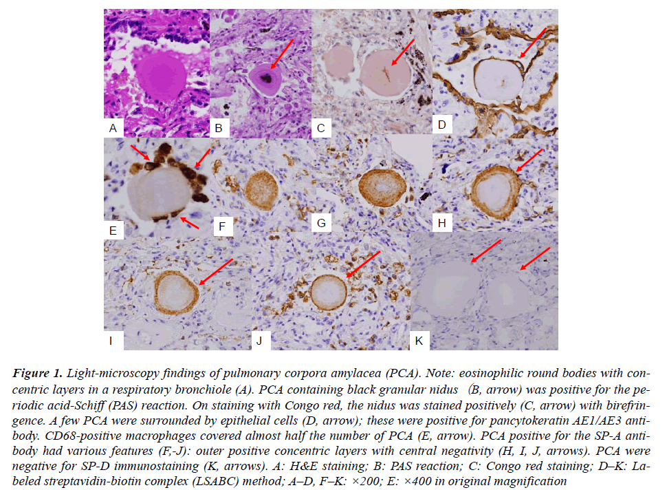 biomedres-Light-microscopy-pulmonary-corpora