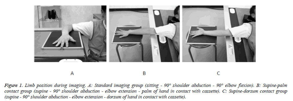 biomedres-Limb-position