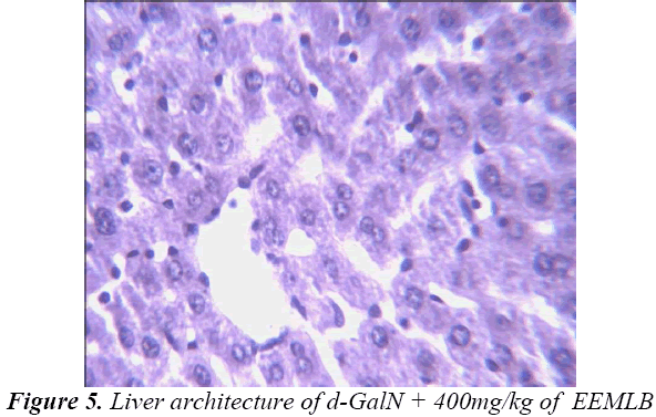 biomedres-Liver-architecture-EEMLB