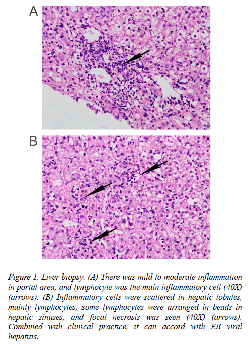 biomedres-Liver-biopsy