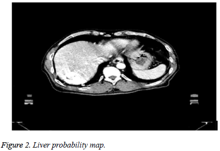 biomedres-Liver-probability