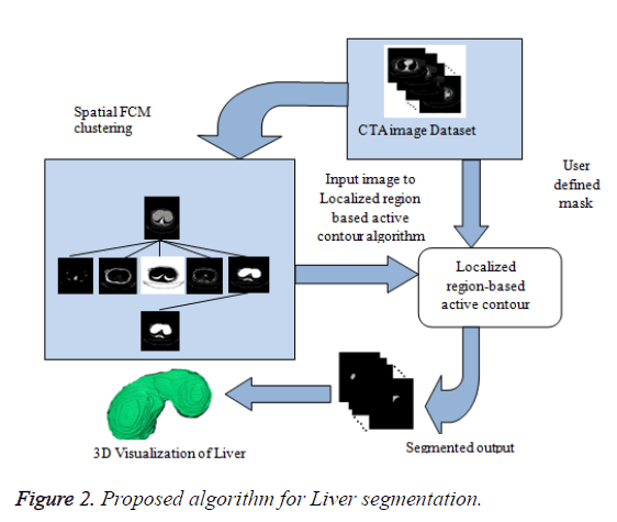 biomedres-Liver-segmentation