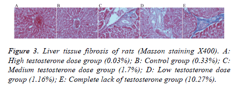 biomedres-Liver-tissue-fibrosis