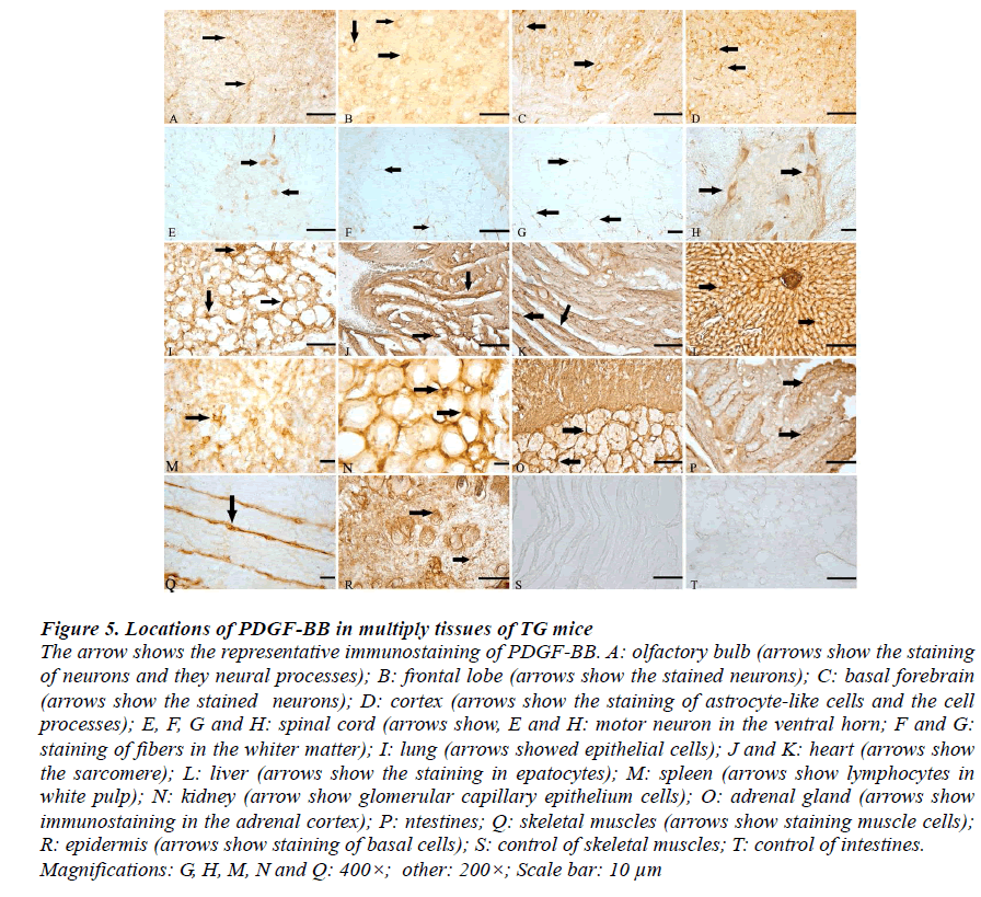 biomedres-Locations-of-PDGF