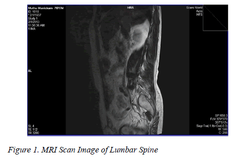 biomedres-Lumbar-Spine