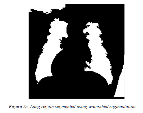 biomedres-Lung-region