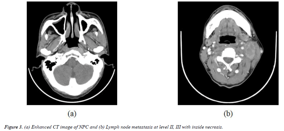 biomedres-Lymph-node