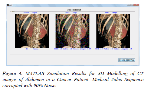 biomedres-MATLAB-Simulation