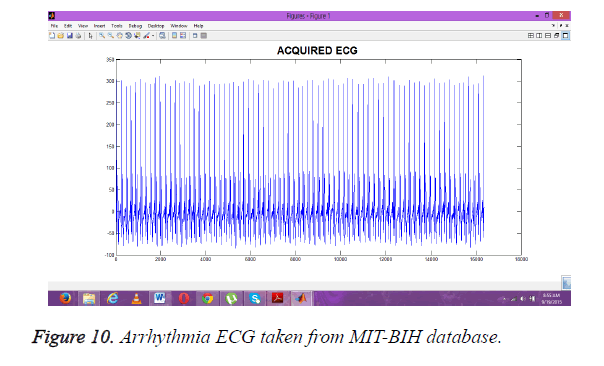 biomedres-MIT-BIH-database