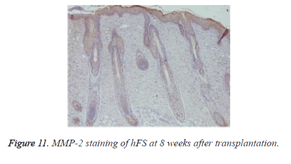 biomedres-MMP-2-staining