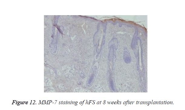 biomedres-MMP-7-staining