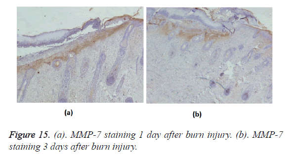 biomedres-MMP-7-staining