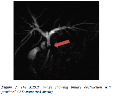 biomedres-MRCP-image