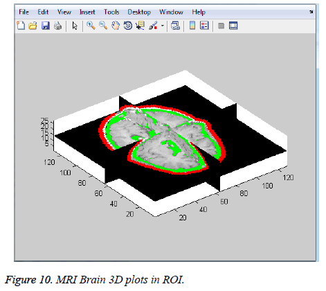 biomedres-MRI-Brain