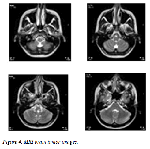biomedres-MRI-brain