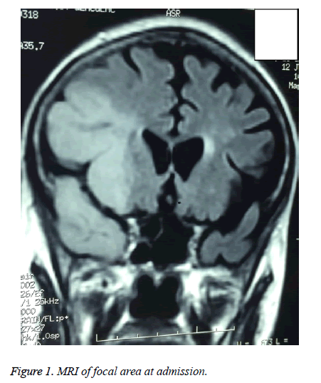 biomedres-MRI-focal