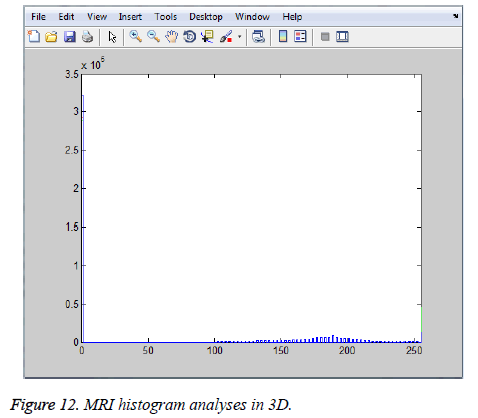 biomedres-MRI-histogram