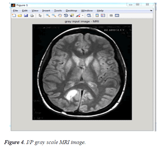 biomedres-MRI-image