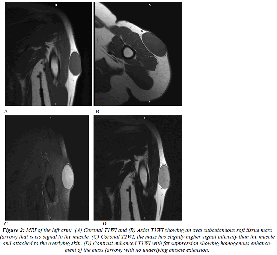 biomedres-MRI-left-arm