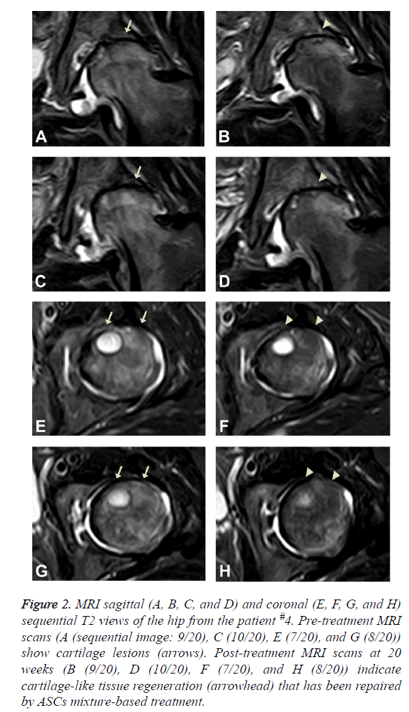 biomedres-MRI-sagittal