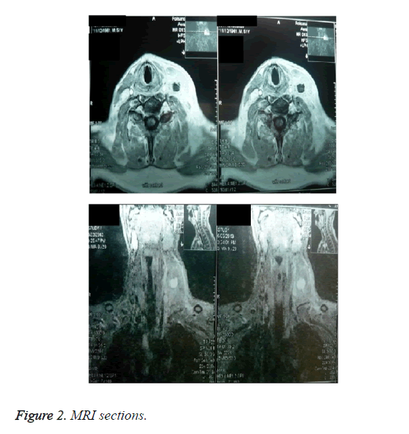 biomedres-MRI-sections