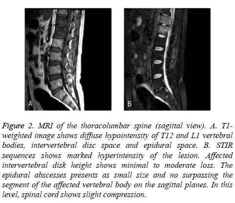 biomedres-MRI-thoracolumbar