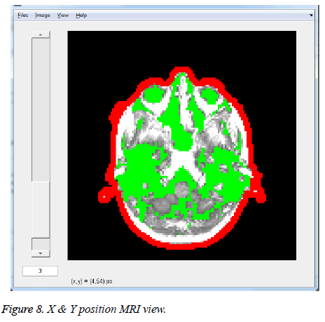 biomedres-MRI-view