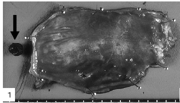 biomedres-Macroscopic-extirpated-gallbladder