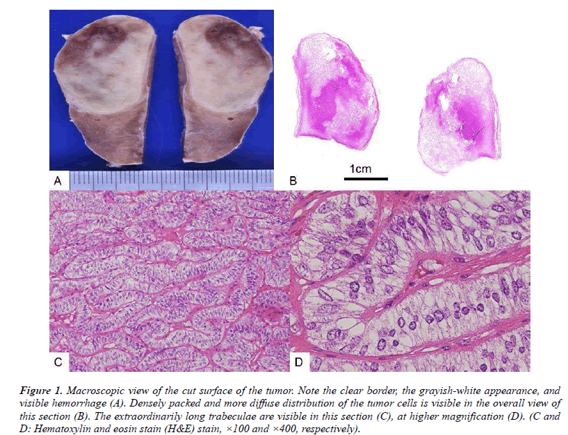 biomedres-Macroscopic-surface-tumor