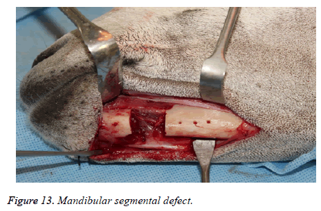 biomedres-Mandibular-segmental