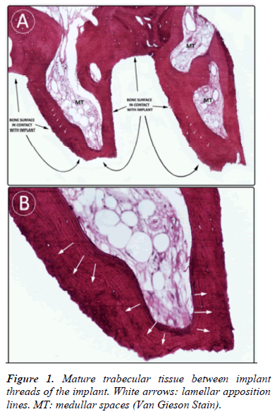 biomedres-Mature-trabecular-tissue