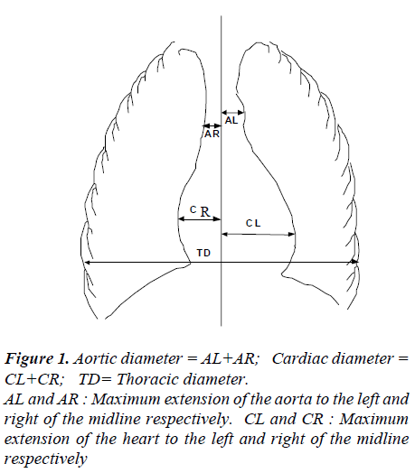 biomedres-Maximum-extension-aorta