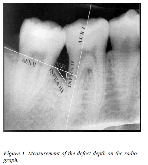 biomedres-Measurement-defect-depth