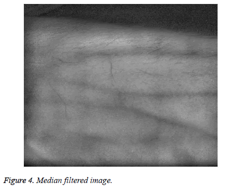 biomedres-Median-filtered-image