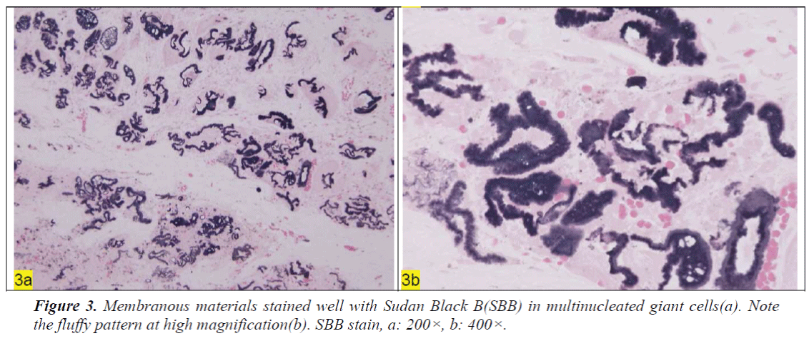 biomedres-Membranous-materials-stained