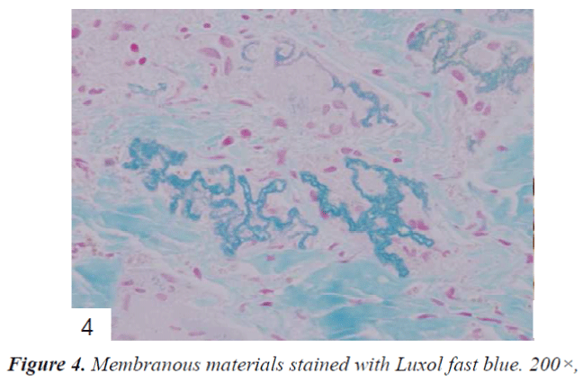 biomedres-Membranous-materials-stained