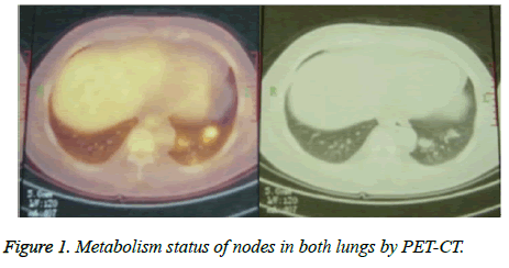 biomedres-Metabolism-status