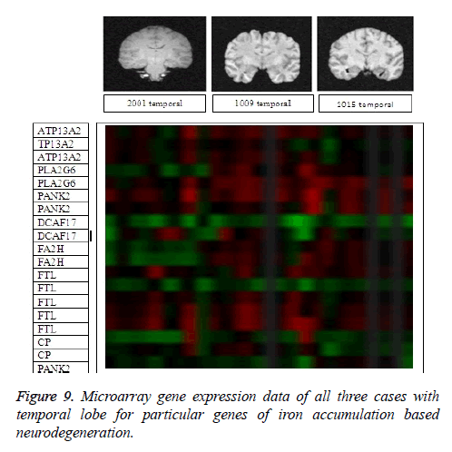 biomedres-Microarray-gene-expression