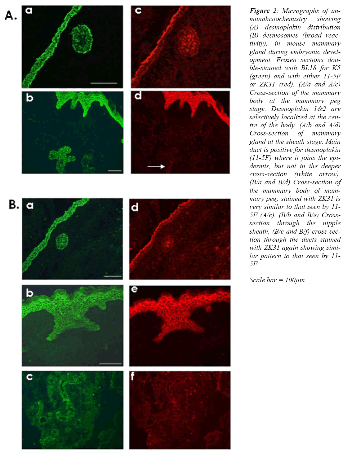 biomedres-Micrographs-munohistochemistry-desmoplakin