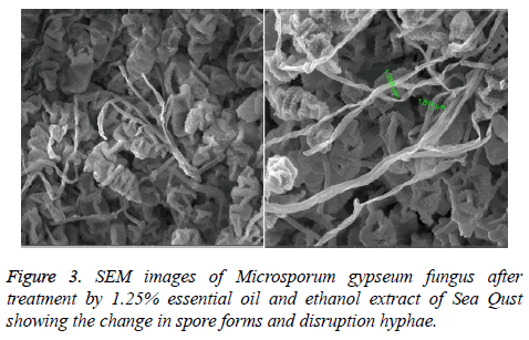 biomedres-Microsporum-gypseum