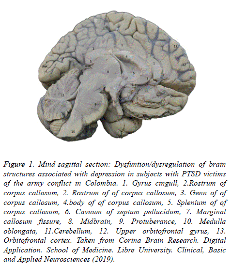 biomedres-Mind-sagittal